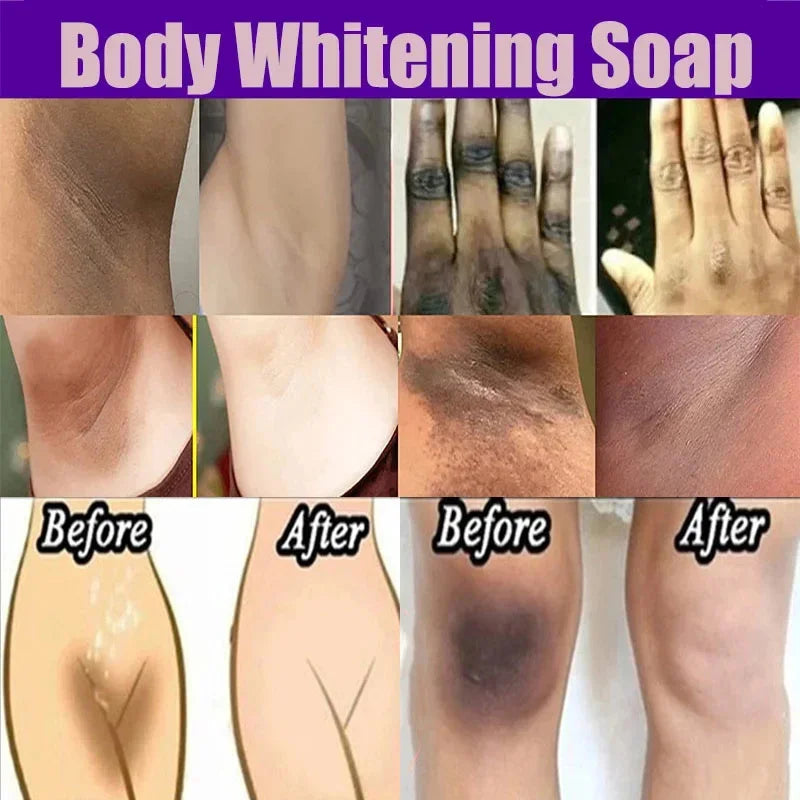 Body Whitening Soap Deep Clean Skin Chicken Skin Removal Soap Armpit Underarm Knees Bleaching Body Brighten White Care Products - null - Fashion Fossil -  