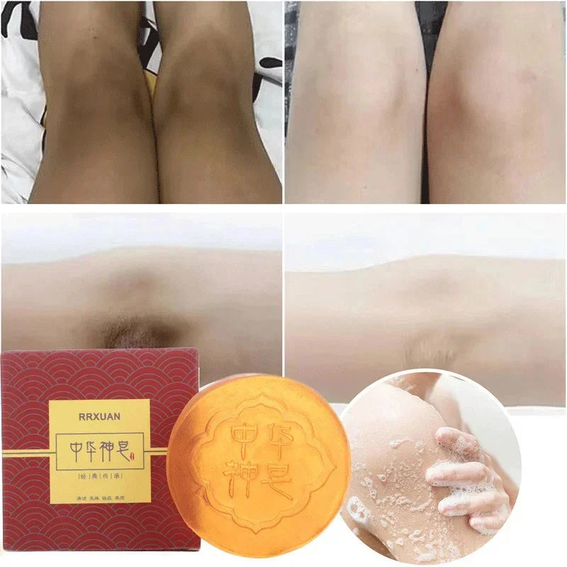 Body Whitening Soap Deep Clean Skin Chicken Skin Removal Soap Armpit Underarm Knees Bleaching Body Brighten White Care Products - null - Fashion Fossil -  